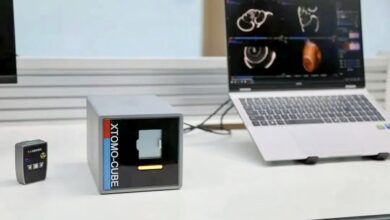 ساخت کوچک‌ترین دستگاه CT جهان با ۶ کیلوگرم وزن